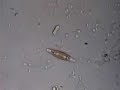 Spiral bacteria do their thing Spiral bacteria do their thing