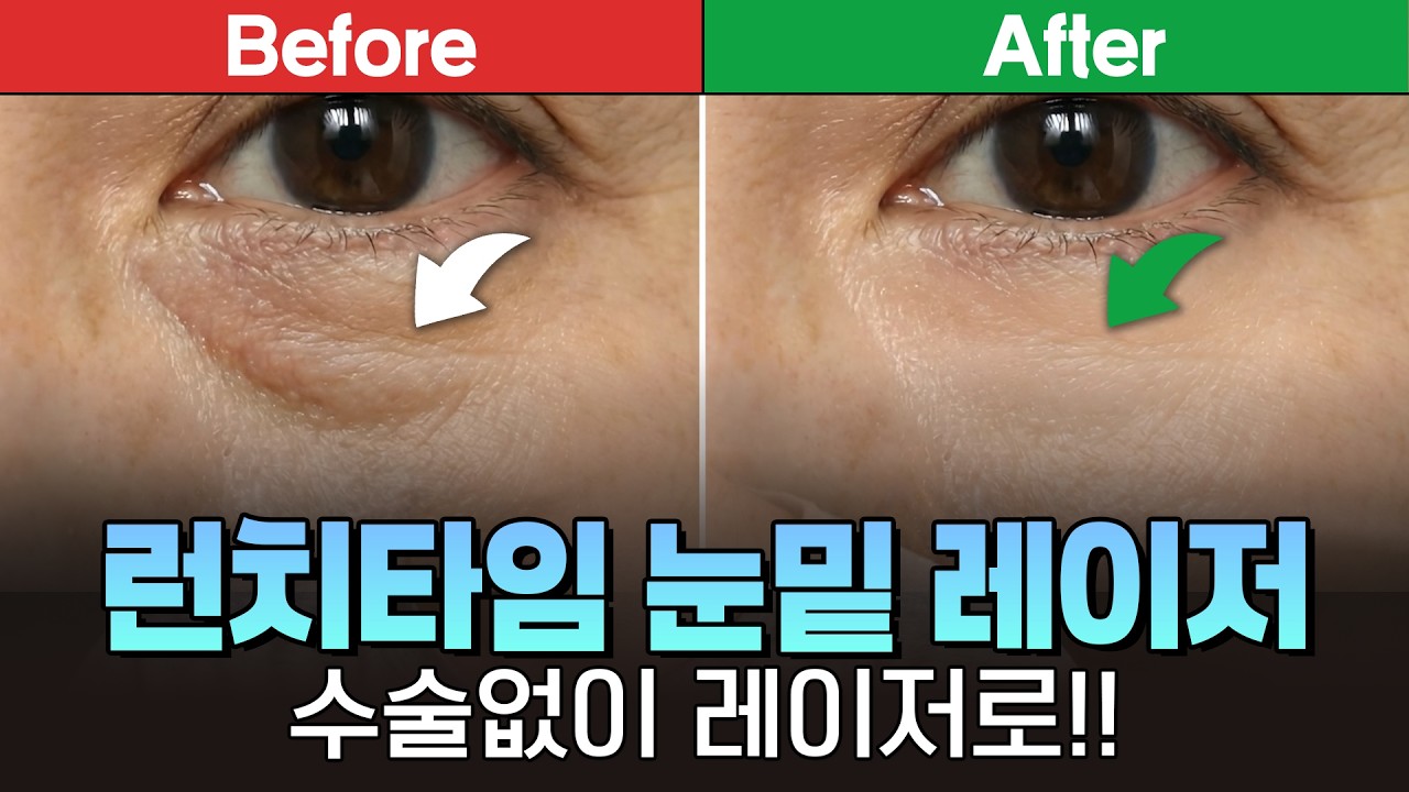 연세스타피부과 TV