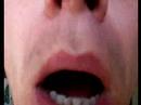 Lip-Plop-Job Lip-Plop-Job
