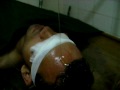 Shirodhara - Shirodhara