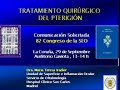 operacion de pterigion