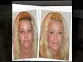 LifeCell Anti Wrinkle Cream
