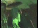 Neck Sprain-Intoxicated Live Neck Sprain-Intoxicated Live