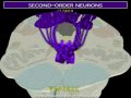 Neuroanatomy - The Dorsal Column-Medial Lemniscus Tract in 3D