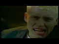die ärtzte - schrei nach liebewenn ihr das lied scheiße findets dann kuqqt es euch nicht an und dchreibt kein kommentar ey