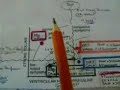 acute heart failure 4 acute heart failure 4