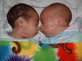 The Story of Kolton and Karter The Story of Kolton and Karter