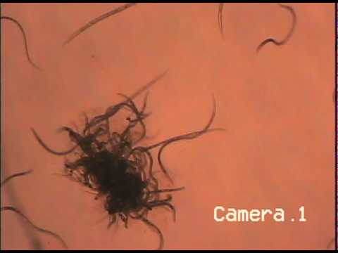 how to collect vinegar eels