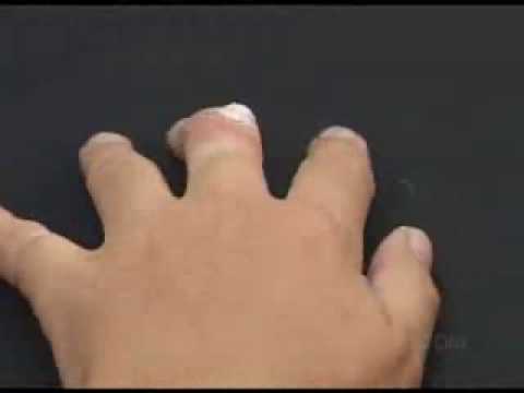 how to remove ez tag