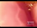 Python Swallows Deer (All Internal Shots) Python Swallows Deer (All Internal Shots)