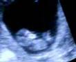 baby Shirey 10 weeks