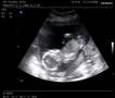 Mommy's unborn baby