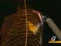 Bionic Arms are Real