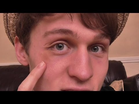 how to get rid o f a black eye