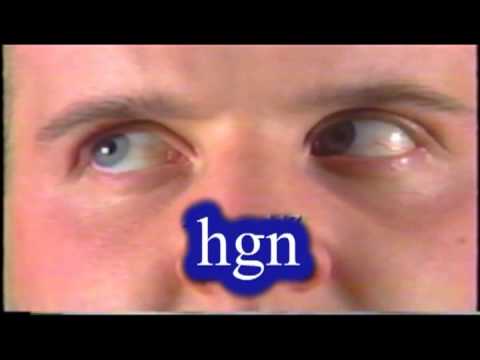 how to perform hgn test