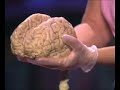 Jill Bolte Taylor scientist with stroke