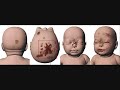 What happened to Baby P and how you can help - Petition Justice Protection What happened to Baby P and how you can help - Petition Justice Protection