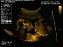 Eco, 21 semanas,  Sofi Larre Borges Hanisch