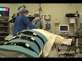 Mini-Gastric Bypass; Anesthesia and Breathing Tube Placement