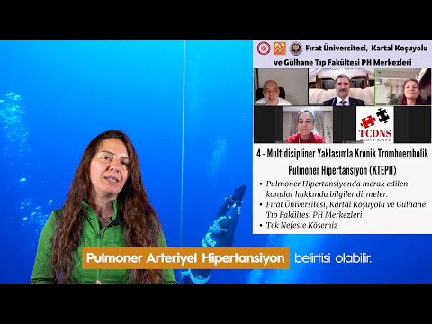 Konu 4: Fırat Üniversitesi, Kartal Koşuyolu ve Gülhane Tıp Fakültesi - Multidisipliner Yaklaşımla Kronik Tromboembolik Pulmoner Hipertansiyon (KTEPH) - 2022.02.23