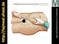 http://tajmeel.ohost.deDr. Mohamed El-RoubyLecturer of Plastic surgery - Faculty of Medicine - Ain Shams University - Cairo - Egypt+2 0101556023 / +2 0126531265dr_mohamed_a@yahoo.com