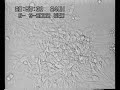 Cellule staminali del cervello