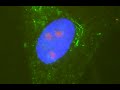 Human fibroblast acquired with AxioCam MR in AxioVision Human fibroblast acquired with AxioCam MR in AxioVision