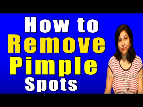 how to remove pimples n marks