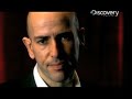 Human Mutations- Conjoined Twins