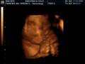 babyboy paredes2