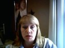 Video #10 - Eleven Weeks Post-Op Video #10 - Eleven Weeks Post-Op