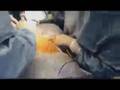 C-Section