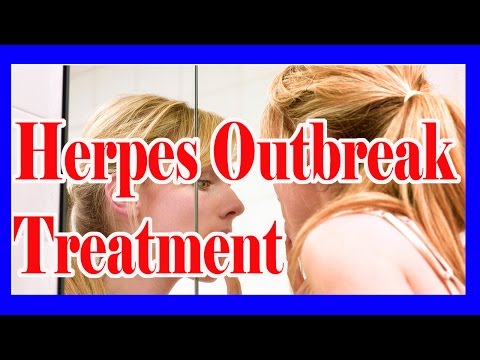 how to cure outbreaks of herpes