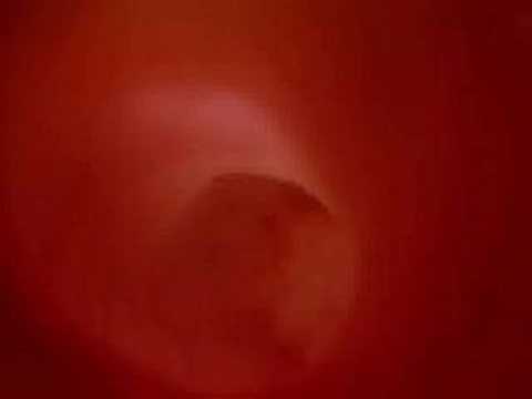 Ver Video