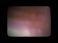 Pleasurekraft - Carny Official Video