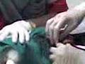 phoebe's operation