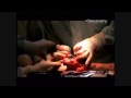 Dedé, el hombre árbol - Parte 4/6 -  Documental - «Misterios»