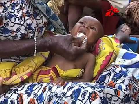 how to treat a child with kwashiorkor