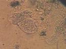 Amoebae in collision