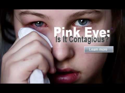 how to treat pink eye