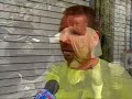 N.H. Man Survives Lightning Strike