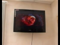 Click here to watch this video В женских консультациях смотрят фильмы