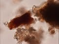 Micronaturaleza II Moviéndose