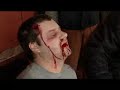 scarce.html
