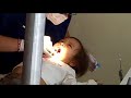 Camila primera  limpieza de dientes