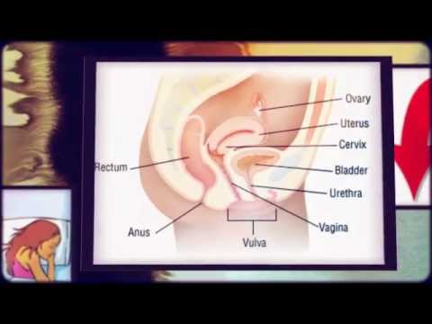 how to treat vaginal discharge