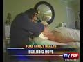 Fox6 