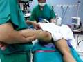 ACL injury knee Pivot shift test ตรวจร่างกาย เอ็นหัวเข่าฉีก