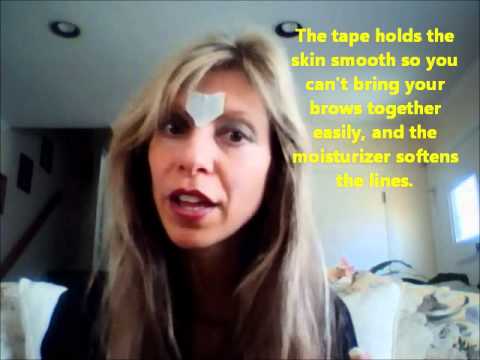 frown - In this video I share with an easy way to get rid of the deep forehead lines that develop from exposure to the sun, smoking, or just repeated facial expressi...
