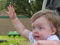 presley's dystonia
update 5/10/08 - she has been diagnosed with spastic diplegic cerebral palsy